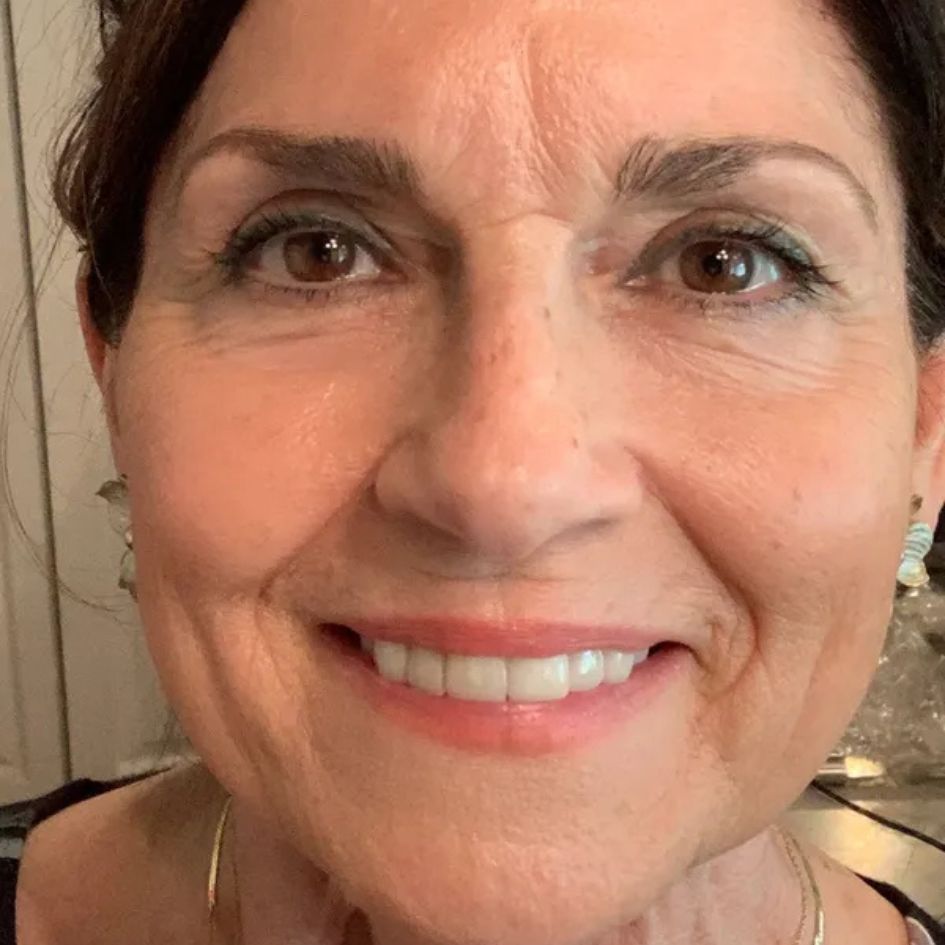 Fièra Bakuchiol Facial Treatment customer