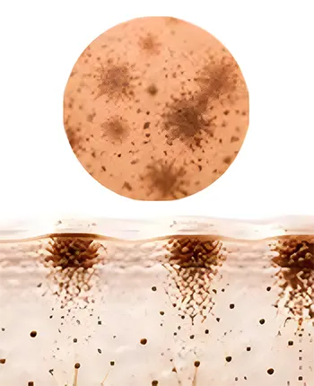 CLUMPED PIGMENT
DISTRIBUTION